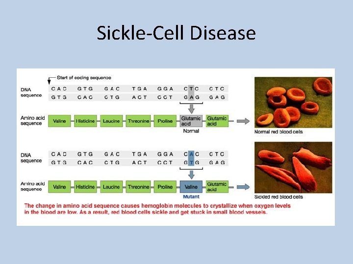 Sickle-Cell Disease 