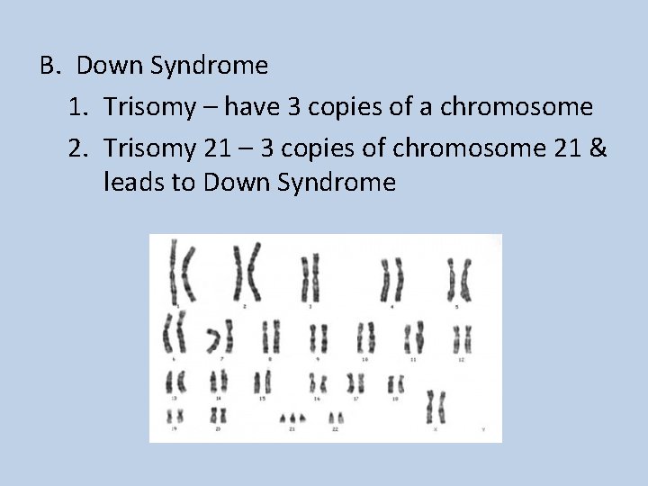 B. Down Syndrome 1. Trisomy – have 3 copies of a chromosome 2. Trisomy