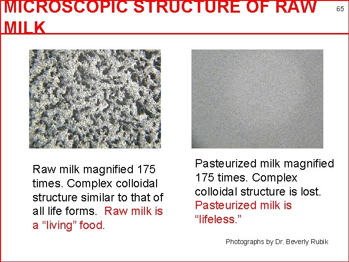 MICROSCOPIC STRUCTURE OF RAW MILK Raw milk magnified 175 times. Complex colloidal structure similar