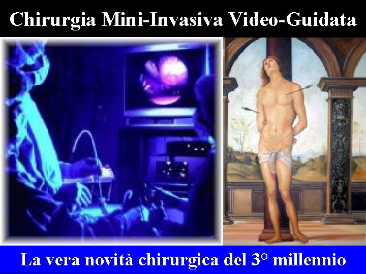Chirurgia Mini-Invasiva Video-Guidata La vera novità chirurgica del 3° millennio 