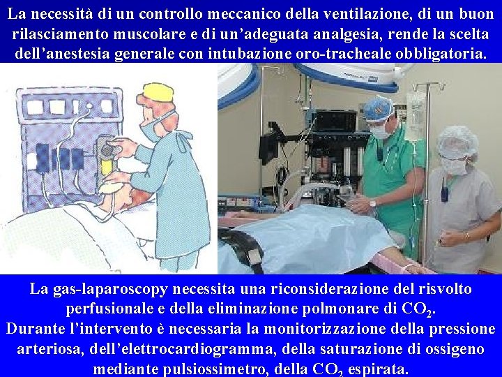La necessità di un controllo meccanico della ventilazione, di un buon rilasciamento muscolare e
