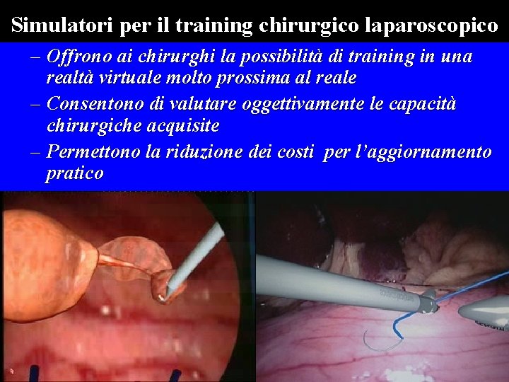 Simulatori per il training chirurgico laparoscopico – Offrono ai chirurghi la possibilità di training