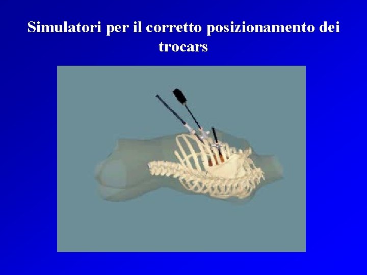 Simulatori per il corretto posizionamento dei trocars 
