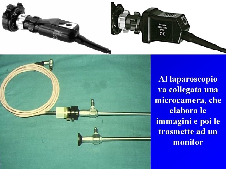 Al laparoscopio va collegata una microcamera, che elabora le immagini e poi le trasmette