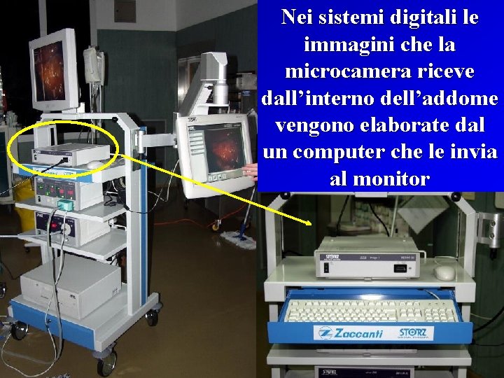 Nei sistemi digitali le immagini che la microcamera riceve dall’interno dell’addome vengono elaborate dal