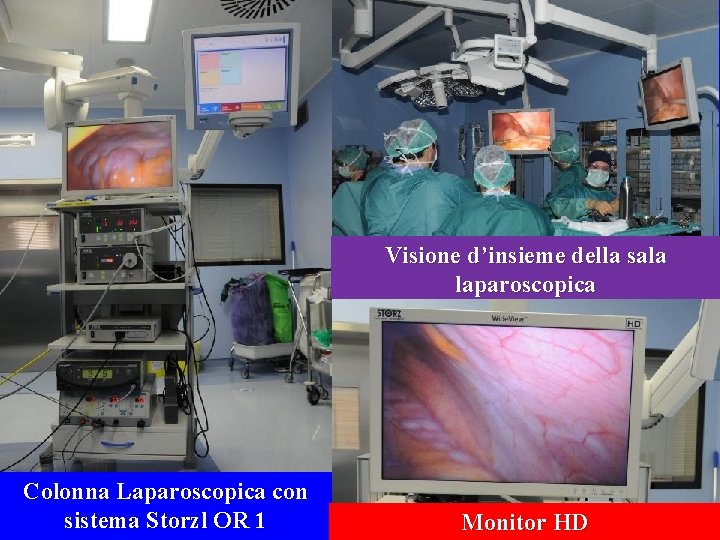 Visione d’insieme della sala laparoscopica Colonna Laparoscopica con sistema Storzl OR 1 Monitor HD