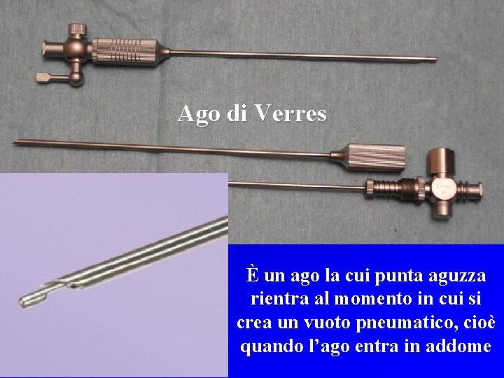 L’ago di Verres Ago di Verres È un ago la cui punta aguzza rientra