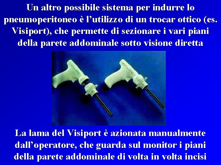 Un altro possibile sistema per indurre lo pneumoperitoneo è l’utilizzo di un trocar ottico