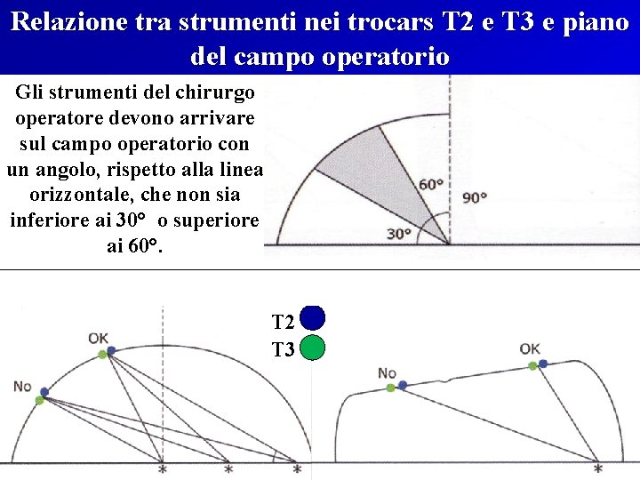 Relazione tra strumenti nei trocars T 2 e T 3 e piano del campo