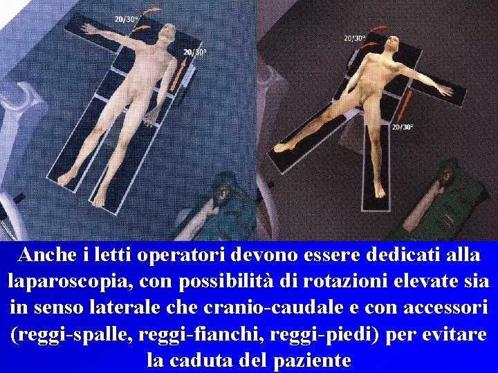 Anche i letti operatori devono essere dedicati alla laparoscopia, con possibilità di rotazioni elevate