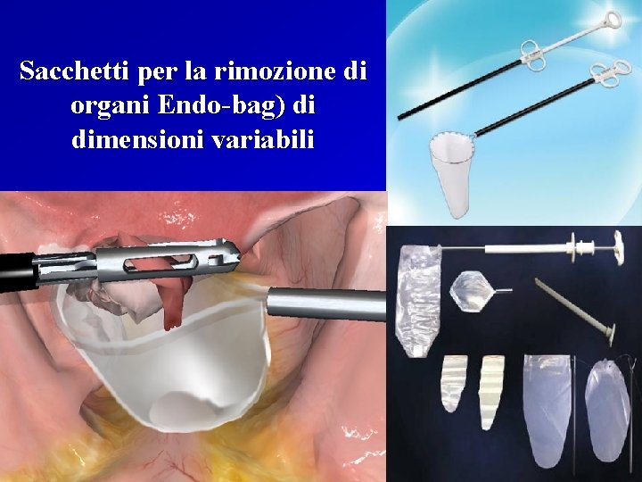 Sacchetti per la rimozione di organi Endo-bag) di dimensioni variabili 
