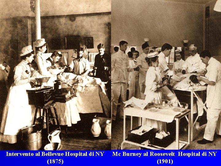 Intervento al Bellevue Hospital di NY (1875) Mc Burney al Roosevelt Hospital di NY