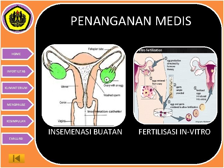 PENANGANAN MEDIS HOME INFERTILITAS KLIMAKTERIUM MENOPAUSE KESIMPULAN INSEMENASI BUATAN EVALUASI FERTILISASI IN-VITRO 