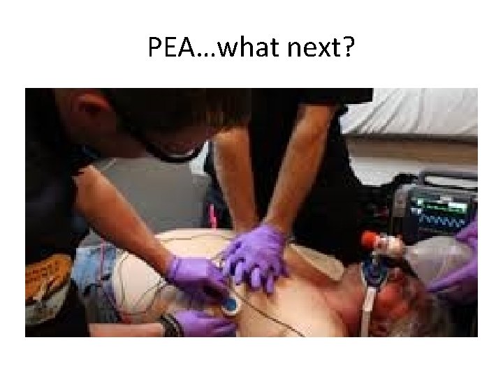 PEA…what next? 