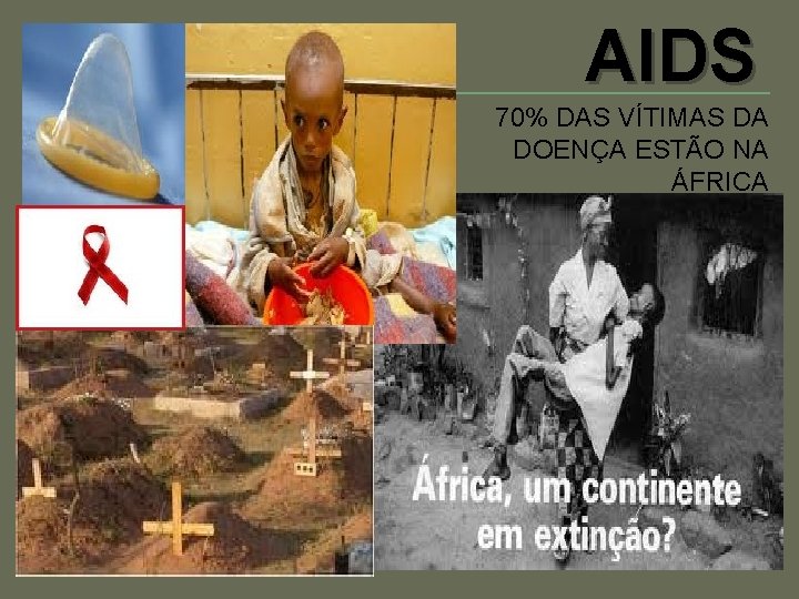 AIDS 70% DAS VÍTIMAS DA DOENÇA ESTÃO NA ÁFRICA SUBSAARIANA 