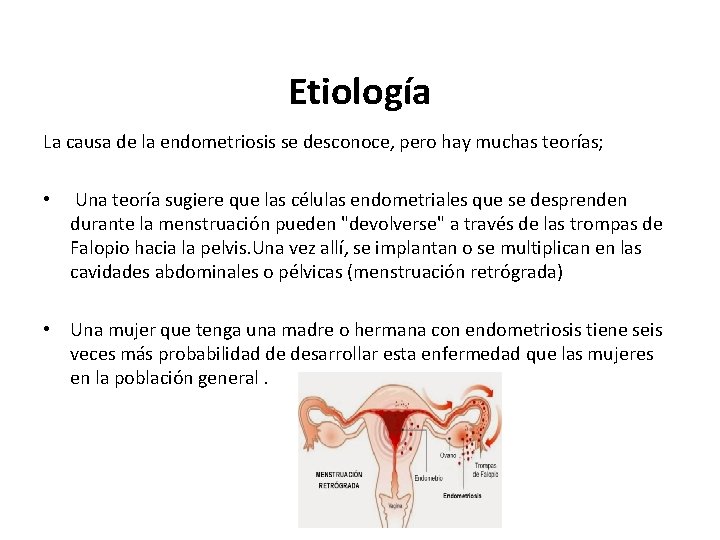 Etiología La causa de la endometriosis se desconoce, pero hay muchas teorías; • Una