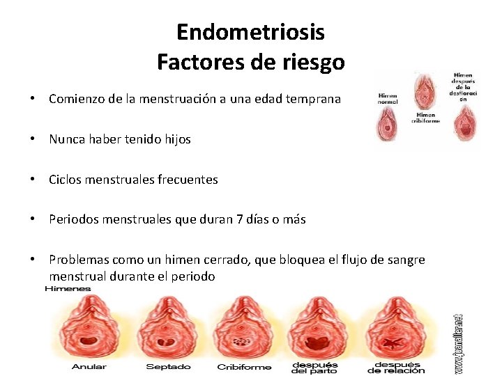 Endometriosis Factores de riesgo • Comienzo de la menstruación a una edad temprana •