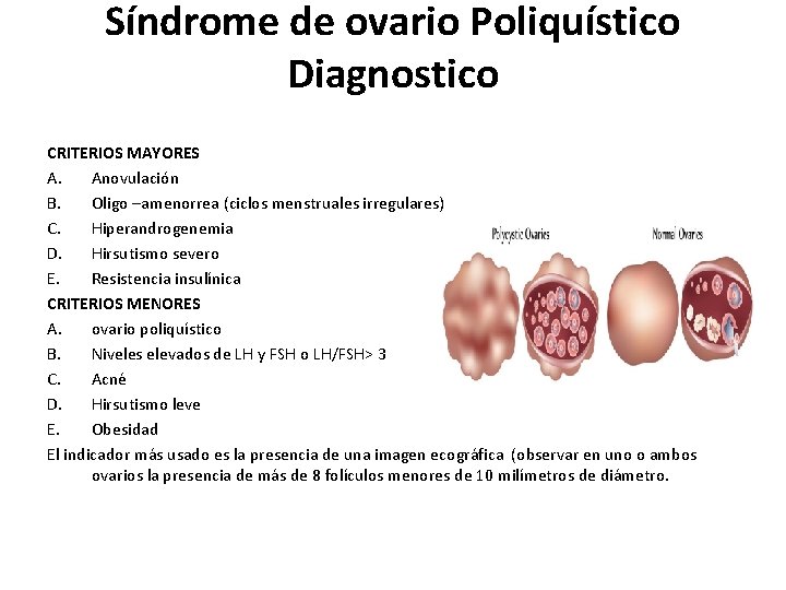 Síndrome de ovario Poliquístico Diagnostico CRITERIOS MAYORES A. Anovulación B. Oligo –amenorrea (ciclos menstruales