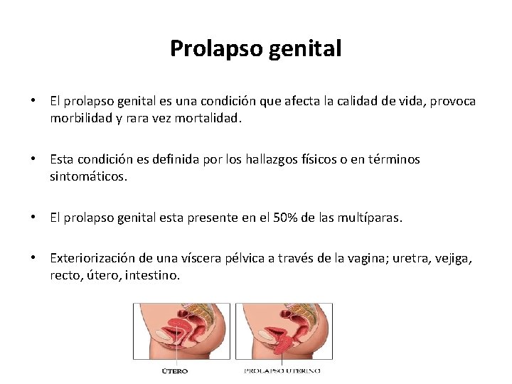 Prolapso genital • El prolapso genital es una condición que afecta la calidad de