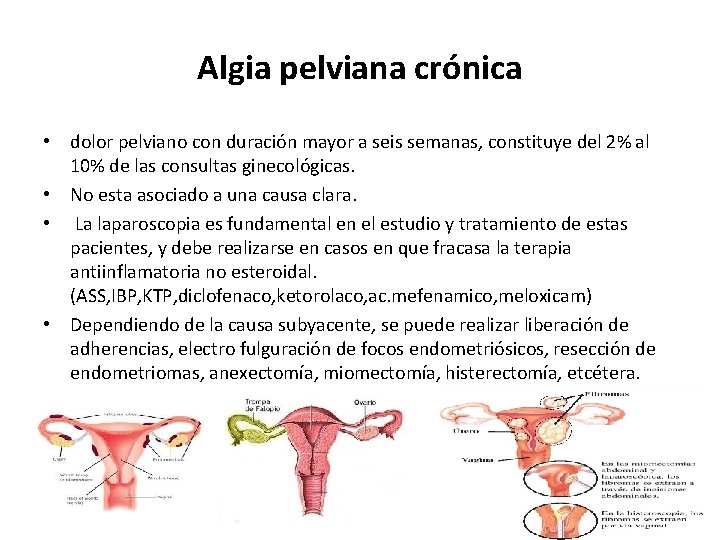 Algia pelviana crónica • dolor pelviano con duración mayor a seis semanas, constituye del