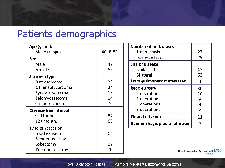 Patients demographics Royal Brompton Hospital Pulmonary Metastasectomy for Sarcoma 