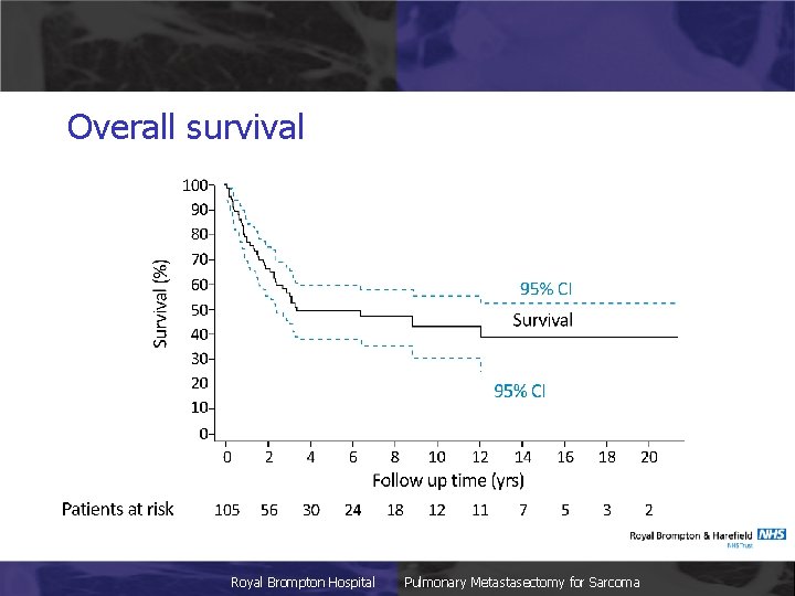 Overall survival Royal Brompton Hospital Pulmonary Metastasectomy for Sarcoma 