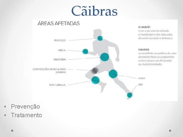 Cãibras • Prevenção • Tratamento 