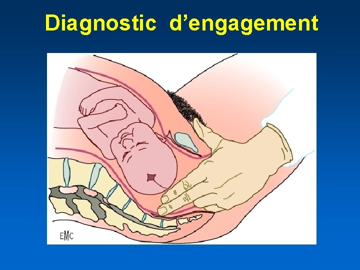 Diagnostic d’engagement 
