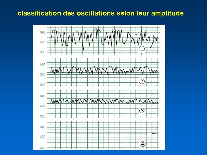 classification des oscillations selon leur amplitude 