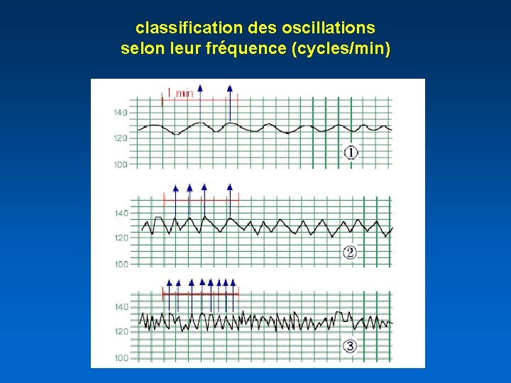 classification des oscillations selon leur fréquence (cycles/min) 