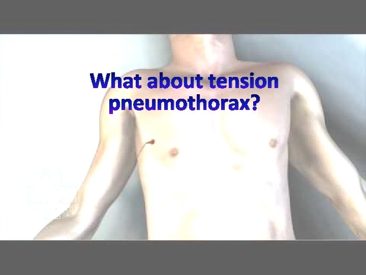 What about tension pneumothorax? 