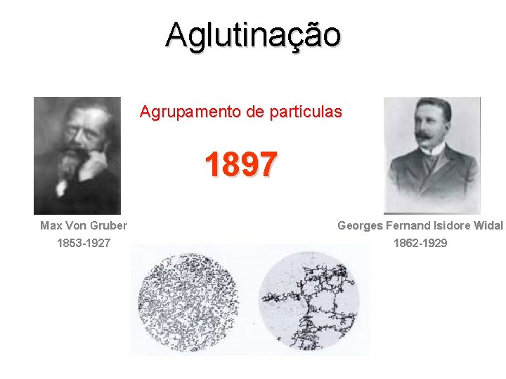 Aglutinação Agrupamento de partículas 1897 Max Von Gruber Georges Fernand Isidore Widal 1853 -1927