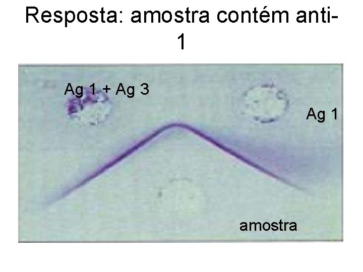 Resposta: amostra contém anti 1 Ag 1 + Ag 3 Ag 1 amostra 