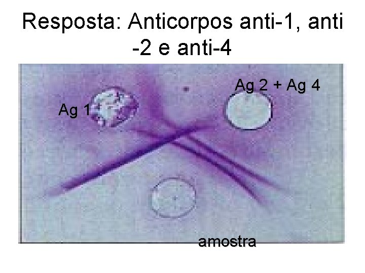 Resposta: Anticorpos anti-1, anti -2 e anti-4 Ag 2 + Ag 4 Ag 1