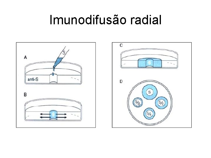 Imunodifusão radial 