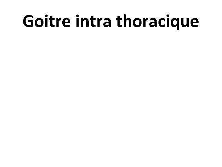 Goitre intra thoracique 