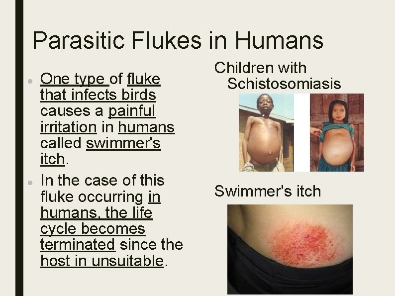 Parasitic Flukes in Humans One type of fluke that infects birds causes a painful