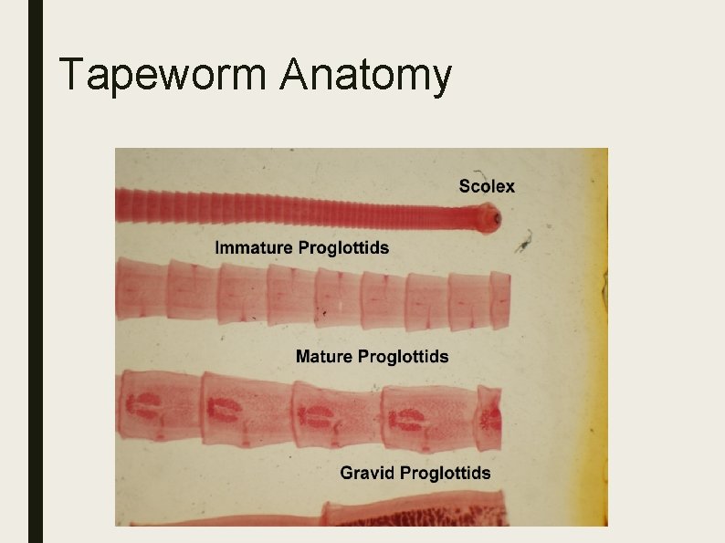 Tapeworm Anatomy 