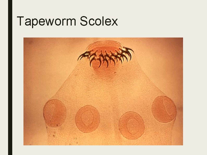 Tapeworm Scolex 