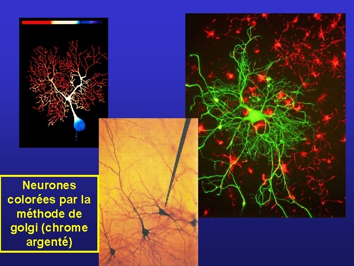 Neurones colorées par la méthode de golgi (chrome argenté) 