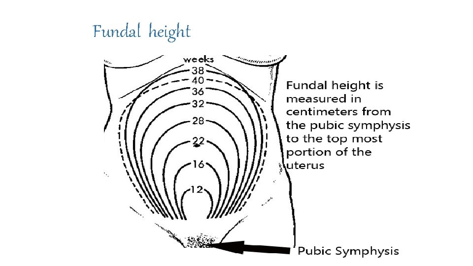 Fundal height Fundal height