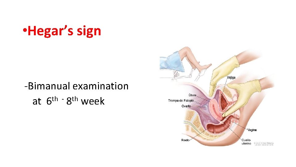• Hegar’s sign -Bimanual examination at 6 th - 8 th week • Hegar’s sign -Bimanual examination at 6 th - 8 th week