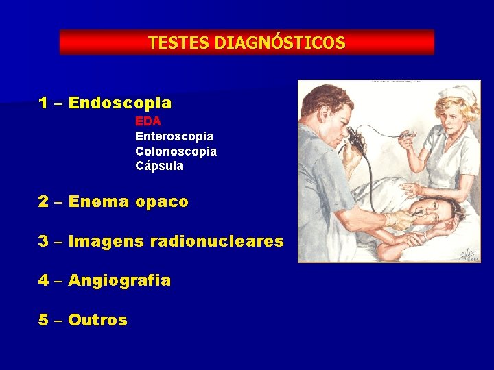 TESTES DIAGNÓSTICOS 1 – Endoscopia EDA Enteroscopia Colonoscopia Cápsula 2 – Enema opaco 3