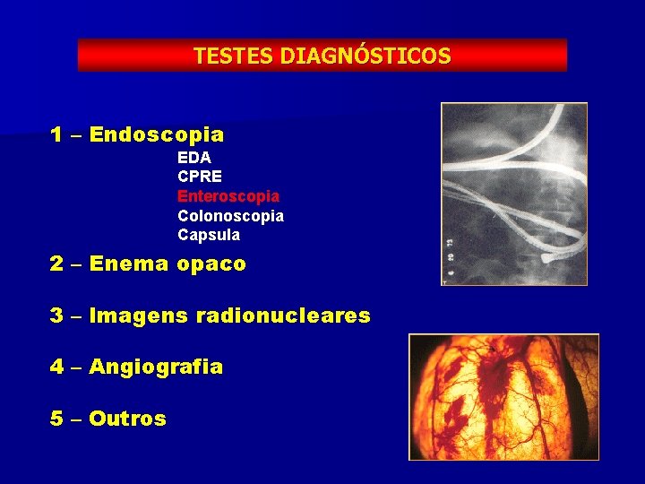 TESTES DIAGNÓSTICOS 1 – Endoscopia EDA CPRE Enteroscopia Colonoscopia Capsula 2 – Enema opaco