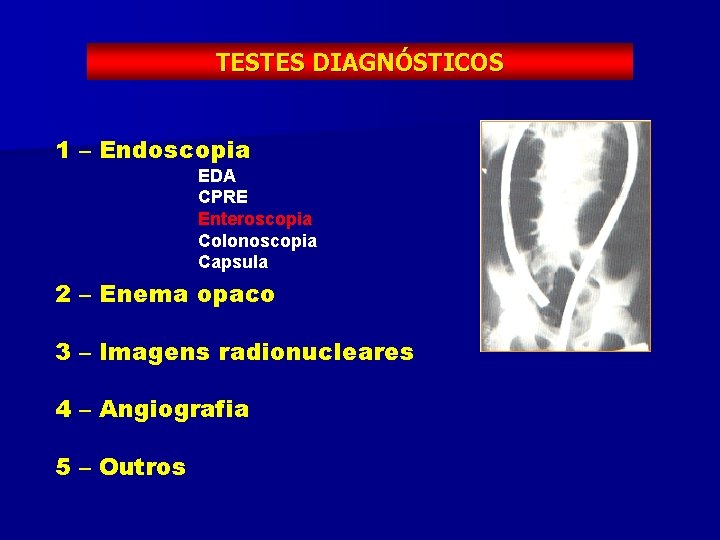 TESTES DIAGNÓSTICOS 1 – Endoscopia EDA CPRE Enteroscopia Colonoscopia Capsula 2 – Enema opaco