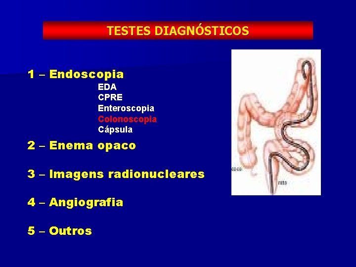 TESTES DIAGNÓSTICOS 1 – Endoscopia EDA CPRE Enteroscopia Colonoscopia Cápsula 2 – Enema opaco