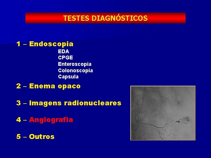 TESTES DIAGNÓSTICOS 1 – Endoscopia EDA CPGE Enteroscopia Colonoscopia Capsula 2 – Enema opaco