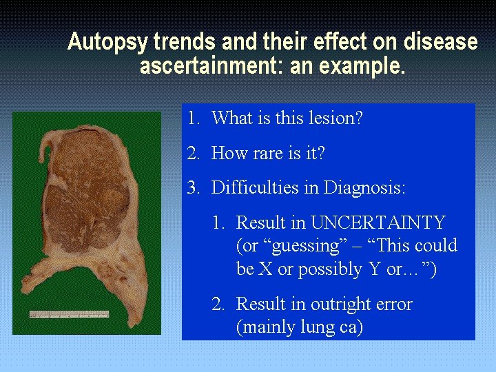 Autopsy trends and their effect on disease ascertainment: an example. 1. 1. What is