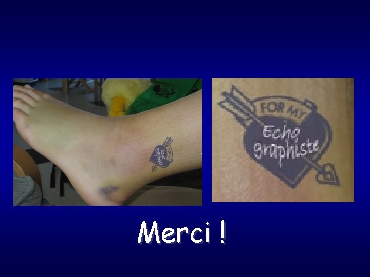 Merci ! 