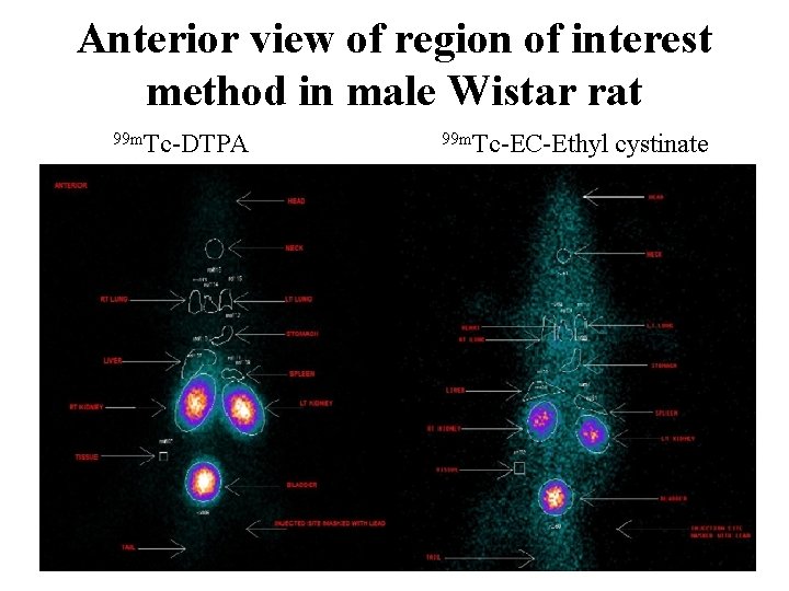 Anterior view of region of interest method in male Wistar rat 99 m. Tc-DTPA